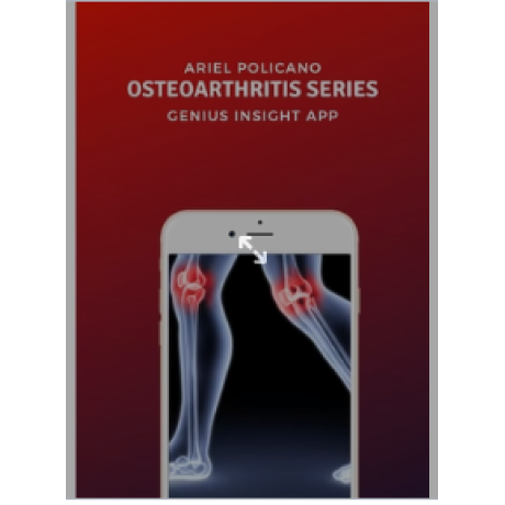 Osteoarthritis Series | Genius Insight | Ariel Policano